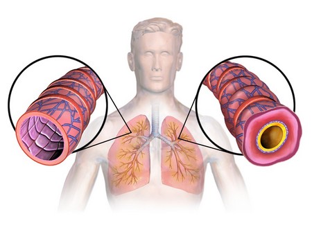 Δωρεάν Σπιρομέτρηση για καπνιστές για έγκαιρη διάγνωση Χρόνιας Αποφρακτικής Πνευμονοπάθειας
